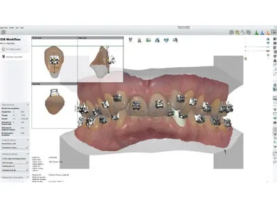 Софт для стоматологии OrthoSystemPremium