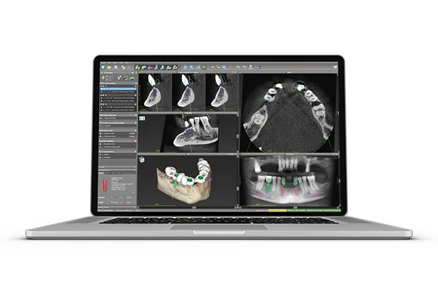 Модуль для DWOS coDiagnostiX