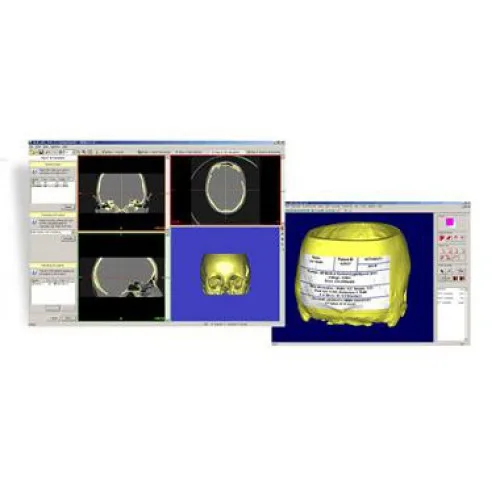 Софт для стоматологии 3D Systems Mimics Z